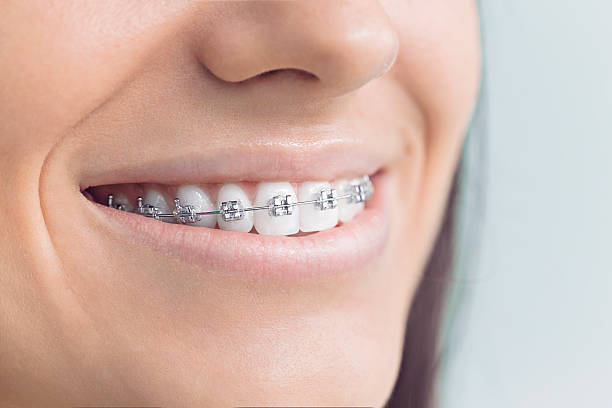 Best Traditional Braces  in Lowell, NC